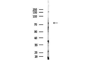 Western blot analysis of lysates from EC304 cells, using DNAJC21 Antibody at 1/1000 dilution.
