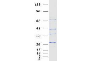Validation with Western Blot