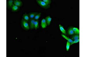 Immunofluorescent analysis of HepG2 cells using ABIN7167270 at dilution of 1:100 and Alexa Fluor 488-congugated AffiniPure Goat Anti-Rabbit IgG(H+L) (RAB27A Antikörper  (AA 2-221))