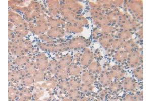 IHC-P analysis of Mouse Kidney Tissue, with DAB staining. (CS Antikörper  (AA 174-428))