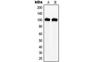 Western blot analysis of NAA15 expression in THP1 (A), HEK293 (B) whole cell lysates. (NAA15 Antikörper  (Center))