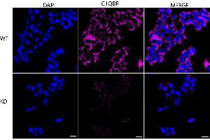 Immunocytochemical staining of HeLa cells using C1QBP antibody (ABIN7798136), 1:1,000), Top panel: wild-type (WT), Bottom panal: C1QBP shRNA knockdown (KD). (Rekombinanter C1QBP Antikörper)