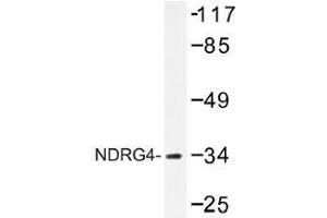 Image no. 1 for anti-NDRG Family Member 4 (NDRG4) antibody (ABIN317933)