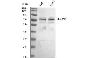 Western blot analysis of CD86 using anti-CD86 antibody (ABIN3042788). (CD86 Antikörper  (AA 24-329))