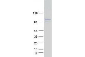 Western Blotting (WB) image for Hook Homolog 3 (HOOK3) protein (Myc-DYKDDDDK Tag) (ABIN2722965)