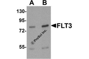 Western Blotting (WB) image for anti-Fms-Related tyrosine Kinase 3 (FLT3) (N-Term) antibody (ABIN1077372) (FLT3 Antikörper  (N-Term))