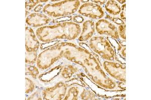 Immunohistochemistry (IHC) image for anti-Prohibitin (PHB) (AA 73-272) antibody (ABIN3020628)