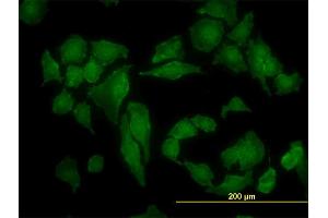 Immunofluorescence (IF) image for anti-Casein Kinase 2 alpha 1 (CSNK2A1) (AA 1-100) antibody (ABIN514706)