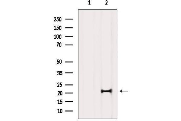 MED29 Antikörper  (Internal Region)