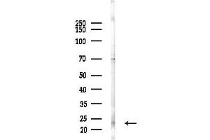 anti-Neurogenin 1 (NEUROG1) (Internal Region) antibody