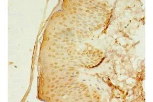 Immunohistochemistry of paraffin-embedded human skin tissue using ABIN7142992 at dilution of 1:100 (SMPDL3A Antikörper  (AA 51-350))