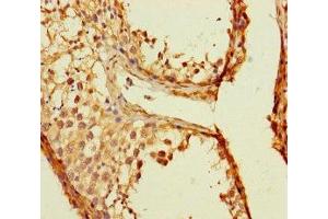 Immunohistochemistry of paraffin-embedded human testis tissue using ABIN7173143 at dilution of 1:100