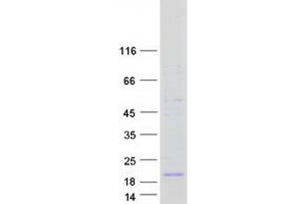 ATP6V0C Protein (Myc-DYKDDDDK Tag)