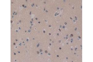 Used in DAB staining on fromalin fixed paraffin- embedded brain tissue (CEBPD Antikörper  (AA 51-252))