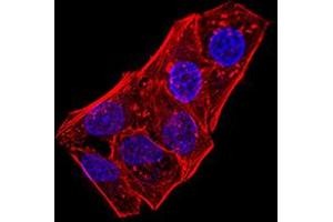 Immunofluorescence (IF) image for anti-ATG5 Autophagy Related 5 (ATG5) (AA 144-275) antibody (ABIN5611293)