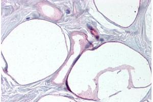 Human Breast, Adipocytes (formalin-fixed, paraffin-embedded) stained with FABP4 antibody ABIN790284 at 10 ug/ml followed by biotinylated goat anti-rabbit IgG secondary antibody ABIN481713, alkaline phosphatase-streptavidin and chromogen. (FABP4 Antikörper  (AA 103-118))
