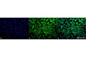 Immunocytochemistry/Immunofluorescence analysis using Rabbit Anti-p38 Polyclonal Antibody . (MAPK14 Antikörper  (FITC))