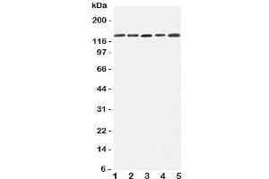 Western blot testing of Integrin alpha 7 antibody and Lane 1:  293T;  2: A431;  3: HeLa;  4: Jurkat;  5: Raji cell lysate.