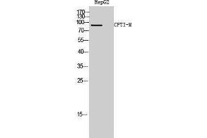 Western Blotting (WB) image for anti-Carnitine Palmitoyltransferase 1B (Muscle) (CPT1B) (Internal Region) antibody (ABIN3174542) (CPT1B Antikörper  (Internal Region))