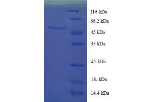 SDS-PAGE (SDS) image for Uncoupling Protein 1 (Mitochondrial, Proton Carrier) (UCP1) (AA 2-307) protein (His-SUMO Tag) (ABIN5710595) (UCP1 Protein (AA 2-307) (His-SUMO Tag))
