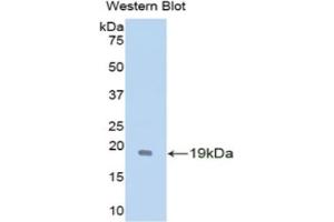 Detection of Recombinant GDNF, Mouse using Polyclonal Antibody to Glial Cell Line Derived Neurotrophic Factor (GDNF) (GDNF Antikörper  (AA 79-217))