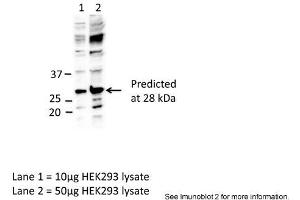 Sample Type: Lane1 = 10ug HEK293 lysateLane 2 = 50ug HEK293 lysatePrimary Antibody Dilution: Anti-EIF4E 1:1000Submitted By: Dr. (EIF4E Antikörper  (C-Term))