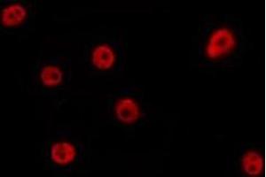 Immunofluorescence (fixed cells) (IF/ICC) image for anti-Zinc Finger, ZZ-Type Containing 3 (ZZZ3) (Internal Region) antibody (ABIN6259236)