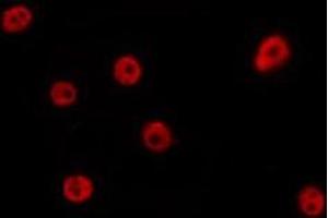ABIN6275695 staining Hela by IF/ICC. (ZZZ3 Antikörper  (Internal Region))