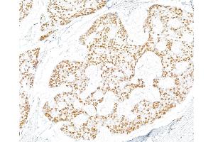 Immunohistochemistry (IHC) image for anti-gamma Histone Variant H2AX (GAMMA-H2AX) (Ser140) antibody (ABIN7454026) (Rekombinanter gamma H2AX Antikörper  (Ser140))