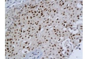Immunohistochemistry (Paraffin-embedded Sections) (IHC (p)) image for anti-Bone Morphogenetic Protein/retinoic Acid Inducible Neural-Specific 1 (BRINP1) (AA 101-200) antibody (ABIN680308)