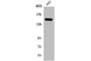 Western Blot analysis of A431 cells using Phospho-PLC β3 (S1105) Polyclonal Antibody (PLCB3 Antikörper  (pSer1105))