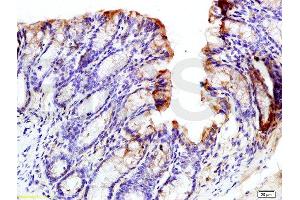Immunohistochemistry (Paraffin-embedded Sections) (IHC (p)) image for anti-Eukaryotic Translation Initiation Factor 2 alpha Kinase 4 (EIF2AK4) (pThr667) antibody (ABIN684958)