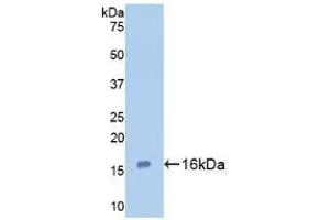 Detection of Recombinant GAL7, Human using Polyclonal Antibody to Galectin 7 (GAL7) (LGALS7 Antikörper  (AA 1-136))