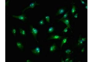 Immunofluorescence staining of U251 cells with ABIN7171462 at 1:100, counter-stained with DAPI.