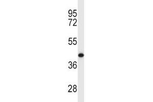 MCL1 antibody western blot analysis in Y79 lysate. (MCL-1 Antikörper  (AA 217-245))