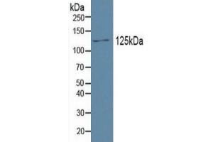 Mouse Capture antibody from the kit in WB with Positive Control: Human testis tissue. (PDGFRA ELISA Kit)