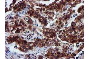 Image no. 8 for anti-Epsin 2 (EPN2) antibody (ABIN1498051) (Epsin 2 Antikörper)