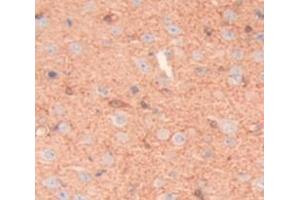 Immunohistochemistry (IHC) image for anti-CD2 (CD2) (AA 27-203) antibody (ABIN1174797)