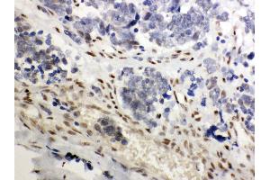 Immunohistochemistry (Paraffin-embedded Sections) (IHC (p)) image for anti-Nuclear Receptor Subfamily 3, Group C, Member 1 (Glucocorticoid Receptor) (NR3C1) (AA 20-199) antibody (ABIN3043371)
