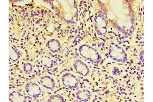 Immunohistochemistry of paraffin-embedded human small intestine tissue using ABIN7152252 at dilution of 1:100 (EXOC2 Antikörper  (AA 1-220))