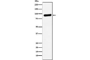 Western Blotting (WB) image for anti-Ribonucleotide Reductase M1 (RRM1) antibody (ABIN7607028)