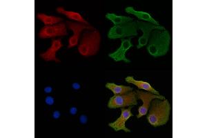 ABIN7094578 and ABIN7098627 staining Hela cells by IF/ICC. (GLS2 Antikörper  (N-Term))