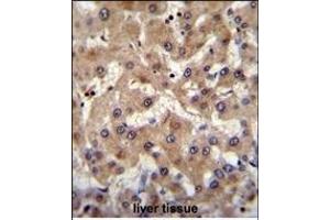 PREF6 Antibody (C-term) (ABIN655365 and ABIN2844922) immunohistochemistry analysis in formalin fixed and paraffin embedded human liver tissue followed by peroxidase conjugation of the secondary antibody and DAB staining. (PRAMEF6 Antikörper  (C-Term))