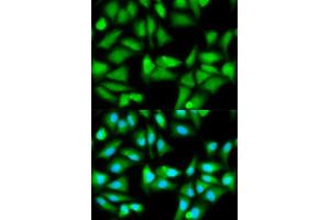 Immunofluorescence analysis of HeLa cell using GSS antibody. (Glutathione Synthetase Antikörper  (AA 1-474))