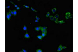 Immunofluorescent analysis of HepG2 cells using ABIN7147620 at dilution of 1:100 and Alexa Fluor 488-congugated AffiniPure Goat Anti-Rabbit IgG(H+L) (Choline Acetyltransferase Antikörper  (AA 354-592))