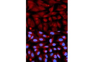 Immunofluorescence analysis of U2OS cells using CD70 antibody (ABIN5971064). (CD70 Antikörper)