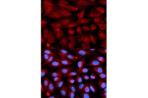 Immunofluorescence analysis of U2OS cells using CD70 antibody (ABIN5971064). (CD70 Antikörper)