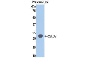 Western blot analysis of the recombinant protein. (SIGLEC5 Antikörper  (AA 18-135))
