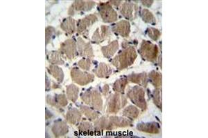 COCH Antibody (Center) immunohistochemistry analysis in formalin fixed and paraffin embedded human skeletal muscle followed by peroxidase conjugation of the secondary antibody and DAB staining. (COCH Antikörper  (Middle Region))