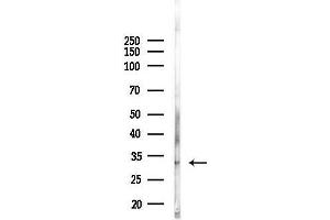 anti-Calcium and Integrin Binding Protein 3 (CIB3) (C-Term) antibody